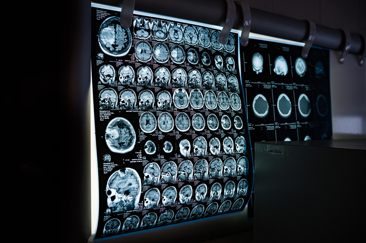 Magnetic Resonance Imaging (MRI)